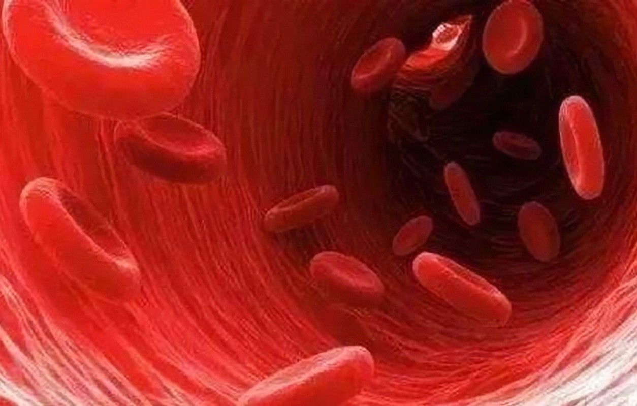 四川蓝生脑科医院提示:高血脂,“动脉硬化”的元凶!堵血管、伤内脏,后患无穷!