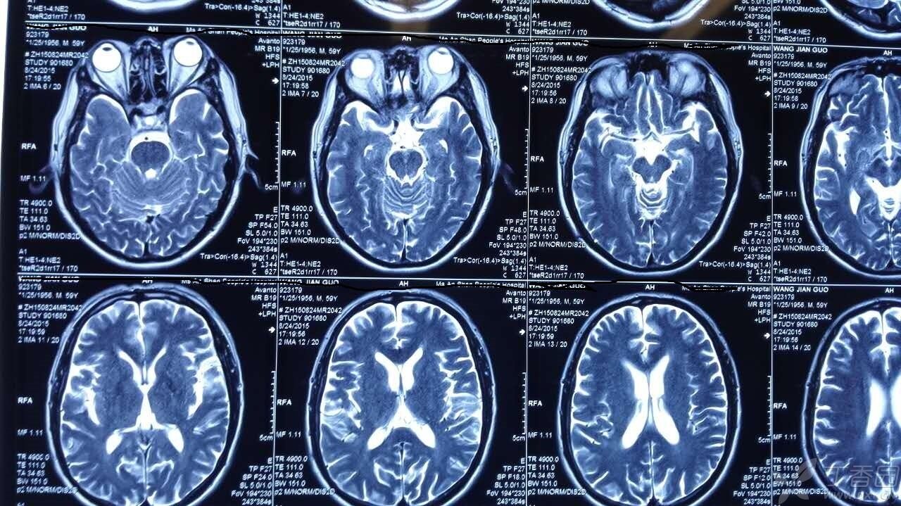 喜讯！四川蓝生脑科医院成为西部自身免疫性脑炎联盟成员单位